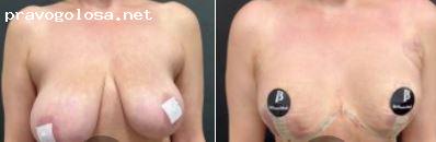 Отзыв на Бутко Александр Игоревич, пластический хирург